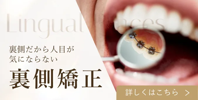裏側だから人目が気にならない 裏側矯正 詳しくはこちら